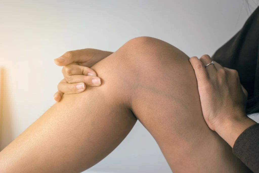 These Are the Most Common Causes of Vein Disease