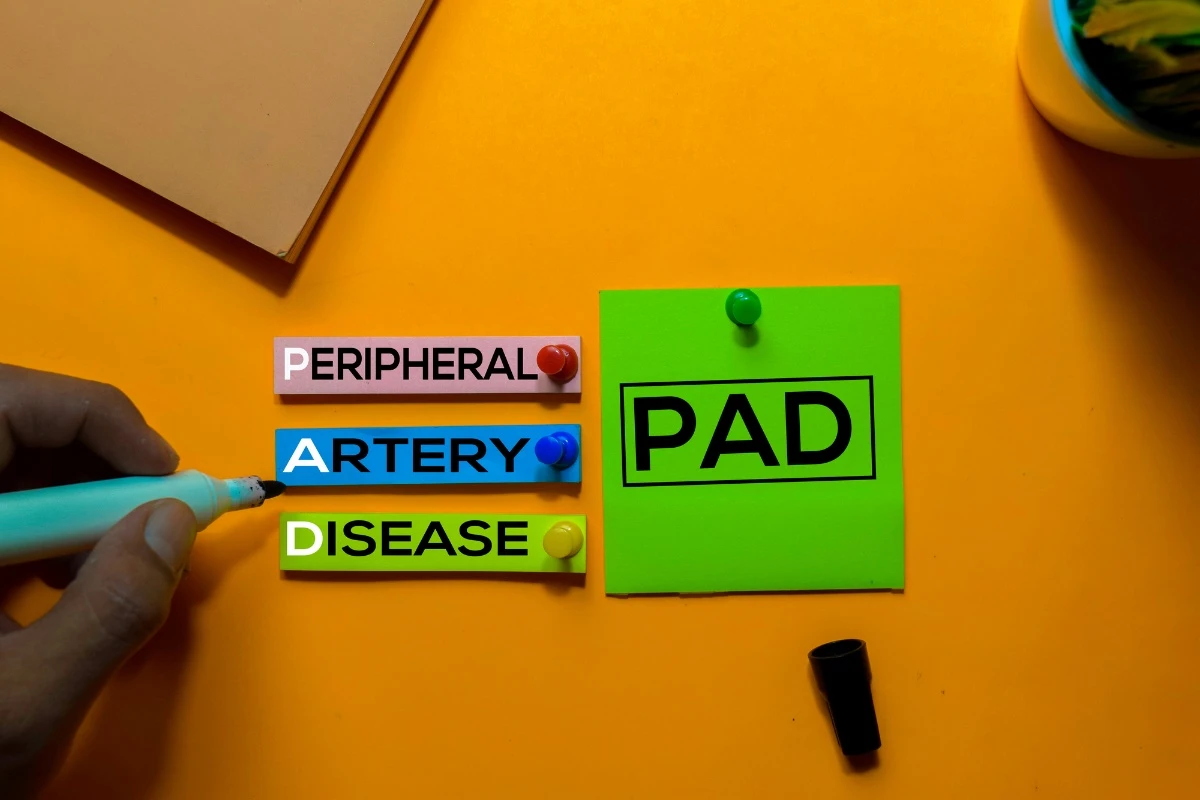 9 Risk Factors for Developing PAD