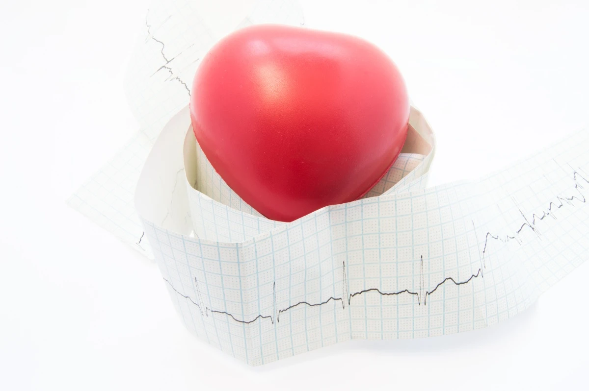 When Does Arrhythmia Require Treatment?