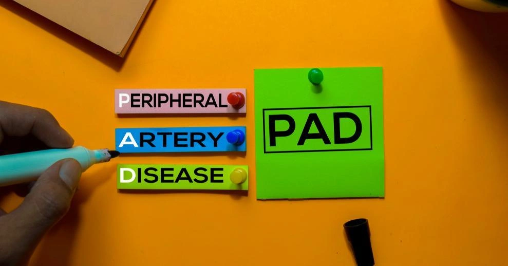 Blog: 9 Risk Factors for Developing PAD