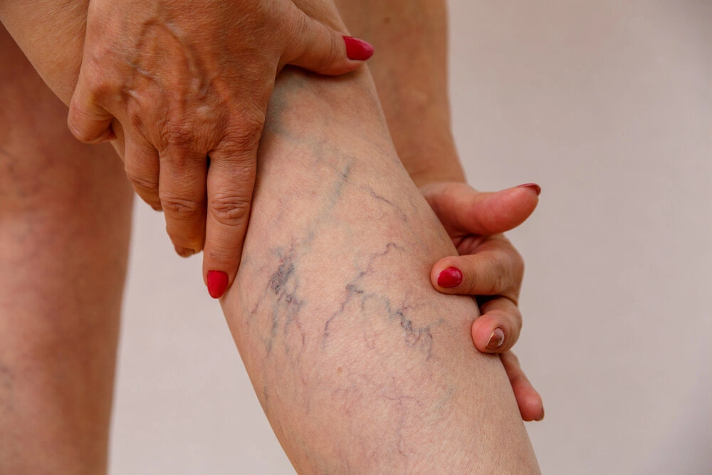 Elderly woman in white panties shows cellulite and varicose veins on a light isolated background