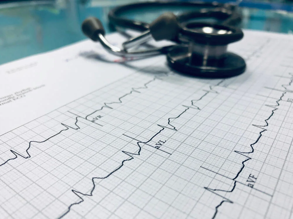 Stethoscope and heart ekg cardiogram of wave in paper report analysis.