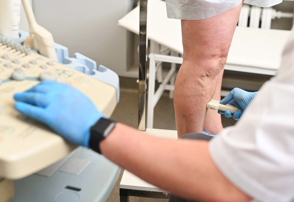 a phlebologist does an ultrasound of the veins of a patient with varicose veins