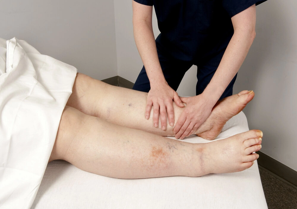 physical therapist treating a patient who has lymphedema