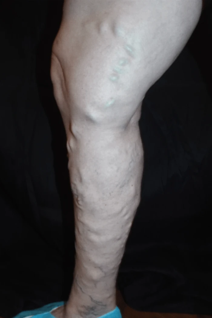 Haufgloechner Before