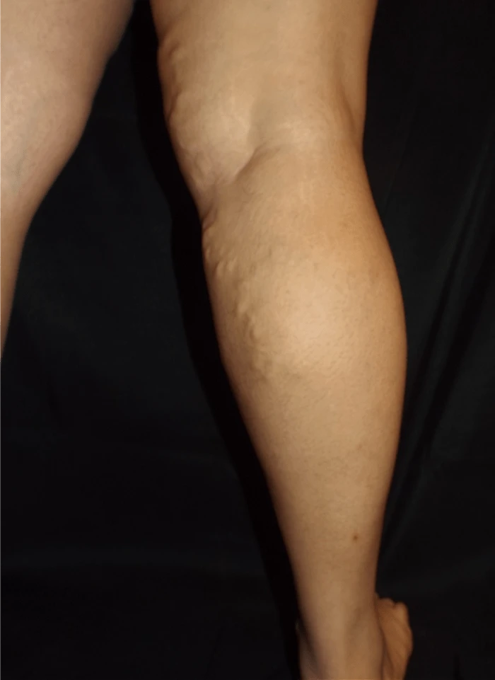 Jackson Briana After