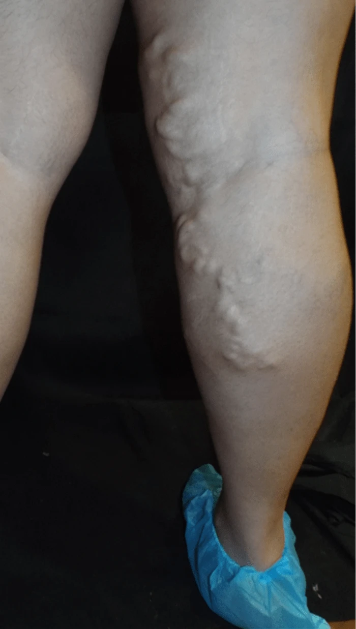 Jackson Briana Before